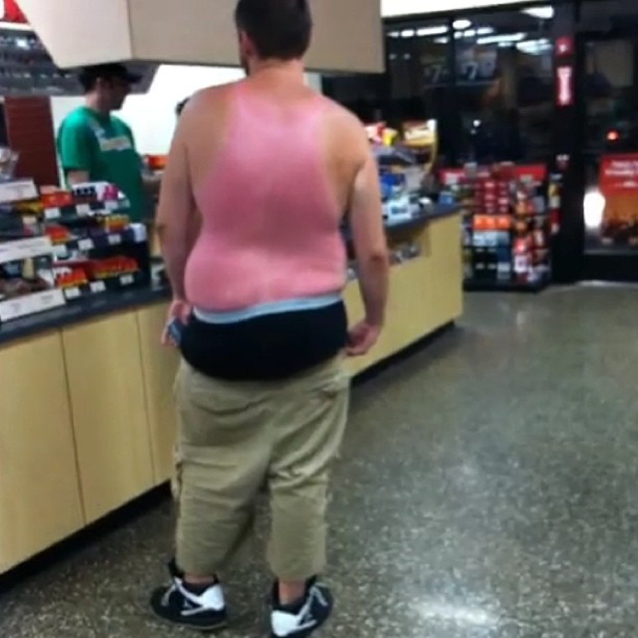 Ok, this reverse tank top sunburn is a little uncomfortable to look at it.  
Photo via hdevil83